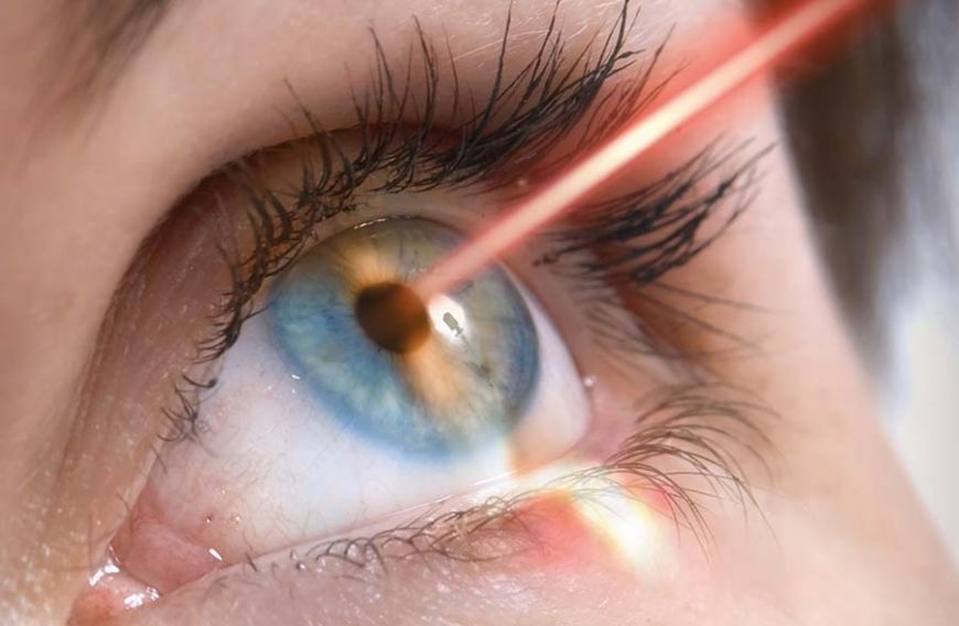 Tecnologia laser per la cura degli occhi: come funziona